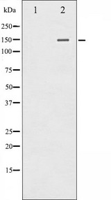 PLCG2 / PLC Gamma 2 Antibody - Western blot analysis of PLCG2 phosphorylation expression in HepG2 whole cells lysates. The lane on the left is treated with the antigen-specific peptide.