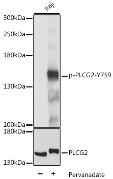 PLCG2 / PLC Gamma 2 Antibody - Western blot analysis of extracts of Raji cells, using Phospho-PLCG2-Y759 antibody at 1:2000 dilution or PLCG2 antibody. Raji cells were treated by Pervanadate (1 mM) at 37â„ƒ for 30 minutes. The secondary antibody used was an HRP Goat Anti-Rabbit IgG (H+L) at 1:10000 dilution. Lysates were loaded 25ug per lane and 3% nonfat dry milk in TBST was used for blocking. Blocking buffer: 3% BSA.An ECL Kit was used for detection and the exposure time was 1s.