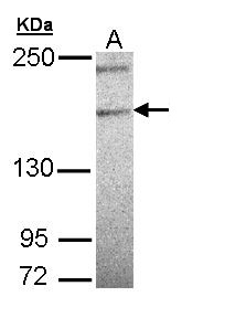 PLCH1 Antibody - Sample (30 ug of whole cell lysate). A:293T. 5% SDS PAGE. PLCH1 antibody diluted at 1:500