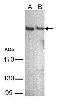 PLCH1 Antibody - Sample (30 ug of whole cell lysate). A: A431 , B: Hep G2 . 5% SDS PAGE. PLCH1 antibody diluted at 1:500