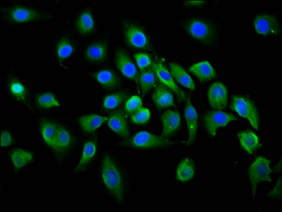 PLCL1 Antibody - Immunofluorescence staining of A549 cells diluted at 1:100, counter-stained with DAPI. The cells were fixed in 4% formaldehyde, permeabilized using 0.2% Triton X-100 and blocked in 10% normal Goat Serum. The cells were then incubated with the antibody overnight at 4°C.The Secondary antibody was Alexa Fluor 488-congugated AffiniPure Goat Anti-Rabbit IgG (H+L).