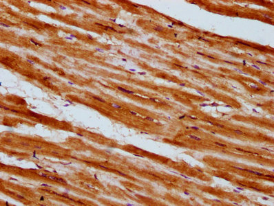 PLCL1 Antibody - Immunohistochemistry Dilution at 1:300 and staining in paraffin-embedded human heart tissue performed on a Leica BondTM system. After dewaxing and hydration, antigen retrieval was mediated by high pressure in a citrate buffer (pH 6.0). Section was blocked with 10% normal Goat serum 30min at RT. Then primary antibody (1% BSA) was incubated at 4°C overnight. The primary is detected by a biotinylated Secondary antibody and visualized using an HRP conjugated SP system.