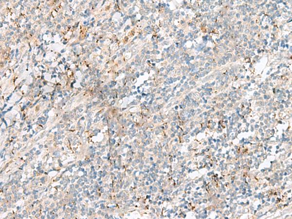 PLCL2 Antibody - Immunohistochemistry of paraffin-embedded Human tonsil tissue  using PLCL2 Polyclonal Antibody at dilution of 1:50(×200)