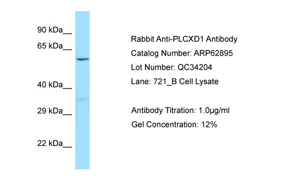 PLCXD1 Antibody -  This image was taken for the unconjugated form of this product. Other forms have not been tested.
