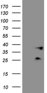 PLCXD1 Antibody - HEK293T cells were transfected with the pCMV6-ENTRY control. (Left lane) or pCMV6-ENTRY PLCXD1. (Right lane) cDNA for 48 hrs and lysed. Equivalent amounts of cell lysates. (5 ug per lane) were separated by SDS-PAGE and immunoblotted with anti-PLCXD1. (1:2000)