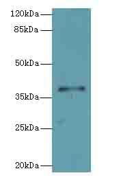 PLCXD1 Antibody - Western blot. All lanes: PLCXD1 antibody at 2 ug/ml+Jurkag- whole cell lysate Goat polyclonal to rabbit at 1:10000 dilution. Predicted band size: 37 kDa. Observed band size: 37 kDa.