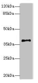 PLCXD1 Antibody - Western blot All lanes: PLCXD1 antibody at 2µg/ml + Jurkat whole cell lysate Secondary Goat polyclonal to rabbit IgG at 1/10000 dilution Predicted band size: 37 kDa Observed band size: 37 kDa