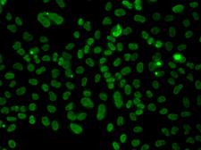 PLCXD2 Antibody - Immunofluorescence analysis of A549 cells.