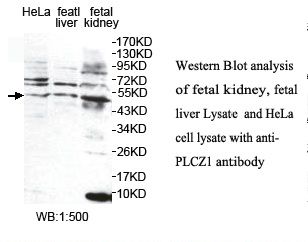 PLCZ1 Antibody