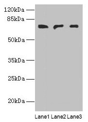 PLCZ1 Antibody - Western blot All lanes: PLCZ1 antibody at 3µg/ml Lane 1: Mouse liver tissue Lane 2: Mouse kidney tissue Lane 3: Human placenta tissue Secondary Goat polyclonal to rabbit IgG at 1/10000 dilution Predicted band size: 71, 48, 58 kDa Observed band size: 71 kDa