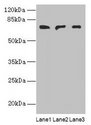 PLCZ1 Antibody - Western blot All lanes: PLCZ1 antibody at 3µg/ml Lane 1: Mouse liver tissue Lane 2: Mouse kidney tissue Lane 3: Human placenta tissue Secondary Goat polyclonal to rabbit IgG at 1/10000 dilution Predicted band size: 71, 48, 58 kDa Observed band size: 71 kDa