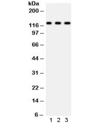 PLD1 / Phospholipase D1 Antibody