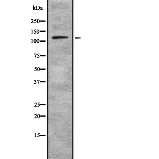 PLD1 / Phospholipase D1 Antibody - Western blot analysis of PLD1 using COLO205 whole lysates.