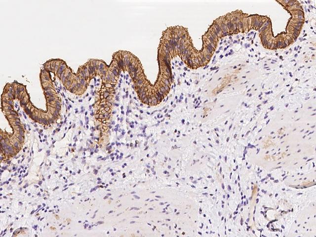 PLD1 / Phospholipase D1 Antibody - Immunochemical staining of human PLD1 in human gallbladder with rabbit polyclonal antibody at 1:500 dilution, formalin-fixed paraffin embedded sections.