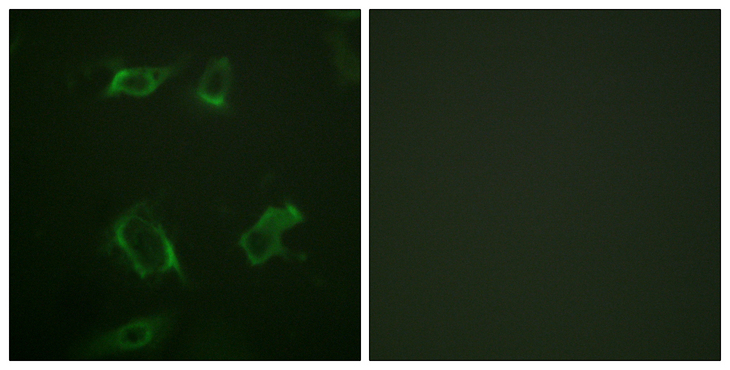 PLD1 / Phospholipase D1 Antibody - Immunofluorescence analysis of HepG2 cells, using PLD1 (Phospho-Ser561) Antibody. The picture on the right is blocked with the phospho peptide.