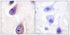 PLD1 / Phospholipase D1 Antibody - Immunohistochemistry analysis of paraffin-embedded human brain, using PLD1 (Phospho-Ser561) Antibody. The picture on the right is blocked with the phospho peptide.