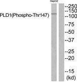 PLD1 / Phospholipase D1 Antibody - Western blot of extracts from HepG2 cells, using PLD1 (Phospho-Thr147) antibody.