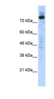 PLD2 / Phospholipase D2 Antibody - PLD2 antibody Western blot of Transfected 293T cell lysate. This image was taken for the unconjugated form of this product. Other forms have not been tested.