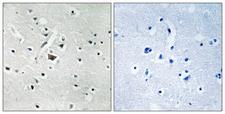 PLD2 / Phospholipase D2 Antibody - Immunohistochemistry analysis of paraffin-embedded human brain, using PLD2 (Phospho-Tyr169) Antibody. The picture on the right is blocked with the phospho peptide.