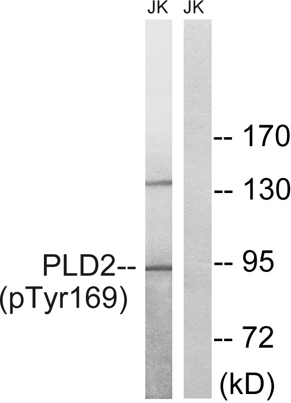 PLD2 / Phospholipase D2 Antibody - Western blot analysis of lysates from Jurkat cells treated with TNF 20ng/ml 30', using PLD2 (Phospho-Tyr169) Antibody. The lane on the right is blocked with the phospho peptide.