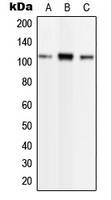 PLD2 / Phospholipase D2 Antibody - Western blot analysis of Phospholipase D2 (pY169) expression in HEK293T TNFa-treated (A); NIH3T3 TNFa-treated (B); H9C2 TNFa-treated (C) whole cell lysates.