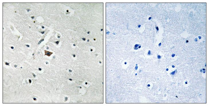 PLD2 / Phospholipase D2 Antibody - P-peptide - + Immunohistochemistry analysis of paraffin-embedded human brain tissue using PLD2 (Phospho-Tyr169) antibody.