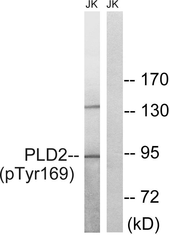 PLD2 / Phospholipase D2 Antibody - Western blot analysis of extracts from Jurkat cells, treated with TNF (20ng/ml, 30mins), using PLD2 (Phospho-Tyr169) antibody.