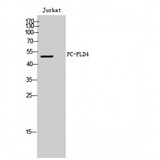 PLD4 / Phospholipase D4 Antibody - Western blot of PC-PLD4 antibody