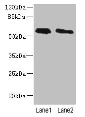 PLD4 / Phospholipase D4 Antibody - Western blot All lanes: PLD4 antibody at 4µg/ml Lane 1: K562 whole cell lysate Lane 2: THP-1 whole cell lysate Lane 3: Human placenta tissue Secondary Goat polyclonal to rabbit IgG at 1/10000 dilution Predicted band size: 56 kDa Observed band size: 56 kDa