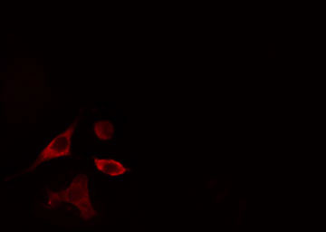 PLD4 / Phospholipase D4 Antibody - Staining HeLa cells by IF/ICC. The samples were fixed with PFA and permeabilized in 0.1% Triton X-100, then blocked in 10% serum for 45 min at 25°C. The primary antibody was diluted at 1:200 and incubated with the sample for 1 hour at 37°C. An Alexa Fluor 594 conjugated goat anti-rabbit IgG (H+L) antibody, diluted at 1/600, was used as secondary antibody.
