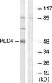 PLD4 / Phospholipase D4 Antibody - Western blot analysis of extracts from Jurkat cells, using PLD4 antibody.