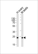 PLD6 / Phospholipase D6 Antibody - Western blot of lysates from human ovary and mouse testis tissue lysates (from left to right), using PLD6 Antibody. Antibody was diluted at 1:1000 at each lane. A goat anti-rabbit IgG H&L (HRP) at 1:5000 dilution was used as the secondary antibody. Lysates at 35ug per lane.
