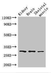 PLD6 / Phospholipase D6 Antibody - Western Blot Positive WB detected in:Mouse kidney tissue,Mouse brain tissue,Mouse skeletal muscle tissue All Lanes: PLD6 antibody at 2.5ug/ml Secondary Goat polyclonal to rabbit IgG at 1/50000 dilution Predicted band size: 29 kDa Observed band size: 29 kDa