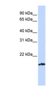 PLDN / Pallidin Antibody - PLDN antibody Western blot of Jurkat lysate. This image was taken for the unconjugated form of this product. Other forms have not been tested.