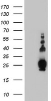 PLDN / Pallidin Antibody - HEK293T cells were transfected with the pCMV6-ENTRY control (Left lane) or pCMV6-ENTRY PLDN (Right lane) cDNA for 48 hrs and lysed. Equivalent amounts of cell lysates (5 ug per lane) were separated by SDS-PAGE and immunoblotted with anti-PLDN.