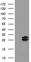 PLDN / Pallidin Antibody - HEK293T cells were transfected with the pCMV6-ENTRY control (Left lane) or pCMV6-ENTRY PLDN (Right lane) cDNA for 48 hrs and lysed. Equivalent amounts of cell lysates (5 ug per lane) were separated by SDS-PAGE and immunoblotted with anti-PLDN.