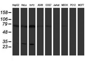 PLDN / Pallidin Antibody - Western blot of extracts (35 ug) from 9 different cell lines by using anti-PLDN monoclonal antibody.
