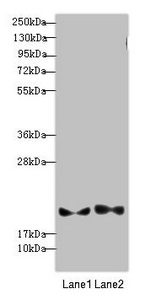 PLDN / Pallidin Antibody - Western blot All Lanes: BLOC1S6 antibody at 3.13 ug/ml Lane 1: A431 whole cell lysate Lane 2: 293T whole cell lysate Secondary Goat polyclonal to rabbit IgG at 1/10000 dilution Predicted band size: 20,9 kDa Observed band size: 20 kDa
