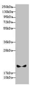 PLDN / Pallidin Antibody - Western blot All lanes: BLOC1S6 antibody at 3.13µg/ml + A431 whole cell lysate Secondary Goat polyclonal to rabbit IgG at 1/10000 dilution Predicted band size: 20, 9 kDa Observed band size: 20 kDa