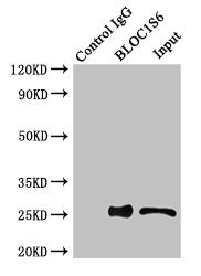 PLDN / Pallidin Antibody - Immunoprecipitating BLOC1S6 in HEK293 whole cell lysate Lane 1: Rabbit monoclonal IgG(1ug)instead of product in HEK293 whole cell lysate.For western blotting, a HRP-conjugated anti-rabbit IgG, specific to the non-reduced form of IgG was used as the Secondary antibody (1/50000) Lane 2: product(4ug)+ HEK293 whole cell lysate(500ug) Lane 3: HEK293 whole cell lysate (20ug)