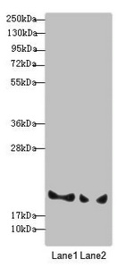 PLDN / Pallidin Antibody - Western blot All Lanes: BLOC1S6 antibody at 3.33 ug/ml Lane 1: A431 whole cell lysate Lane 2: 293T whole cell lysate Secondary Goat polyclonal to rabbit IgG at 1/10000 dilution Predicted band size: 20,9 kDa Observed band size: 20 kDa