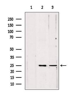 PLDN / Pallidin Antibody - Western blot analysis of extracts of various samples using PLDN antibody. Lane 1: HepG2 treated with blocking peptide. Lane 2: HepG2; Lane 3: 293;