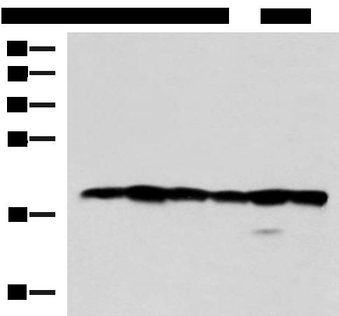 PLDN / Pallidin Antibody - Western blot analysis of 293T Jurkat Hela and 231 cell lysates  using BLOC1S6 Polyclonal Antibody at dilution of 1:600