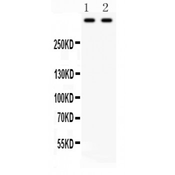 PLEC / Plectin Antibody - Plectin antibody Western blot. All lanes: Anti Plectin at 0.5 ug/ml. Lane 1: HELA Whole Cell Lysate at 40 ug. Lane 2: Rat Brain Tissue Lysate at 50 ug. Predicted band size: 532 kD. Observed band size: 532 kD.