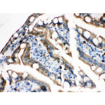 PLEC / Plectin Antibody - Plectin antibody IHC-paraffin. IHC(P): Rat Intestine Tissue.