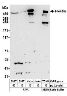 PLEC / Plectin Antibody - Detection of human and mouse Plectin by western blot. Samples: Whole cell lysate from 293T (15 and 50 µg), HeLa (15µg), Jurkat (15µg), and mouse TCMK-1 (15µg) cells prepared using NETN and RIPA lysis buffer. Antibodies: Affinity purified rabbit anti-Plectin antibody used for WB at 0.4 µg/ml. Detection: Chemiluminescence with an exposure time of 30 seconds.