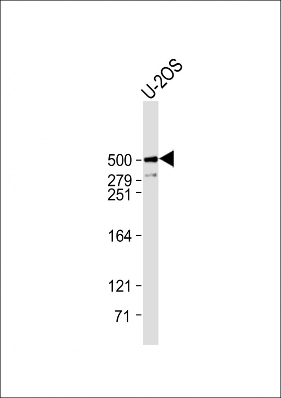 PLEC / Plectin Antibody - Anti-PLEC Antibody (C-Term) at 1:1000 dilution + U-2OS whole cell lysate Lysates/proteins at 20 µg per lane. Secondary Goat Anti-Rabbit IgG, (H+L), Peroxidase conjugated at 1/10000 dilution. Predicted band size: 532 kDa Blocking/Dilution buffer: 5% NFDM/TBST.