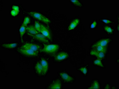 PLEC / Plectin Antibody - Immunofluorescence staining of Hela cells at a dilution of 1:100, counter-stained with DAPI. The cells were fixed in 4% formaldehyde, permeabilized using 0.2% Triton X-100 and blocked in 10% normal Goat Serum. The cells were then incubated with the antibody overnight at 4 °C.The secondary antibody was Alexa Fluor 488-congugated AffiniPure Goat Anti-Rabbit IgG (H+L) .
