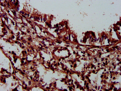 PLEC / Plectin Antibody - Immunohistochemistry image at a dilution of 1:300 and staining in paraffin-embedded human lung tissue performed on a Leica BondTM system. After dewaxing and hydration, antigen retrieval was mediated by high pressure in a citrate buffer (pH 6.0) . Section was blocked with 10% normal goat serum 30min at RT. Then primary antibody (1% BSA) was incubated at 4 °C overnight. The primary is detected by a biotinylated secondary antibody and visualized using an HRP conjugated SP system.