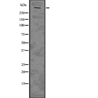 PLEC / Plectin Antibody - Western blot analysis of PLEC using Jurkat whole lysates.